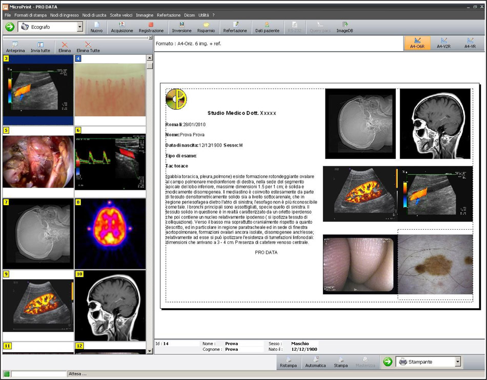 microprint2